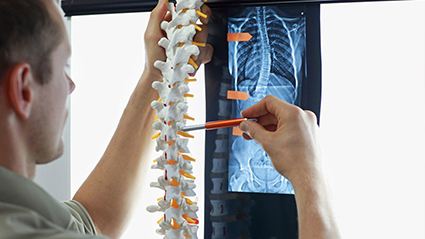 SKOLYOZ HASTALIĞI, TANI VE TEDAVİ GÜNCEL VE YENİ SÜREÇLER!